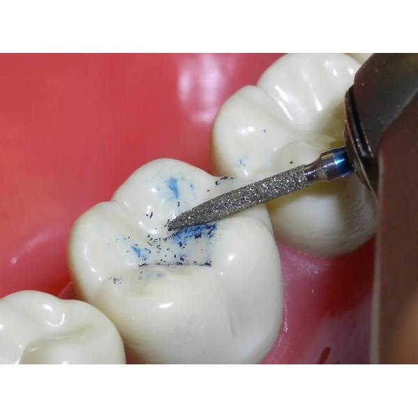 Fraise flamme diamantée retouche céramique Magic Touch