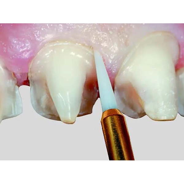 Fraises d'éviction gingivale