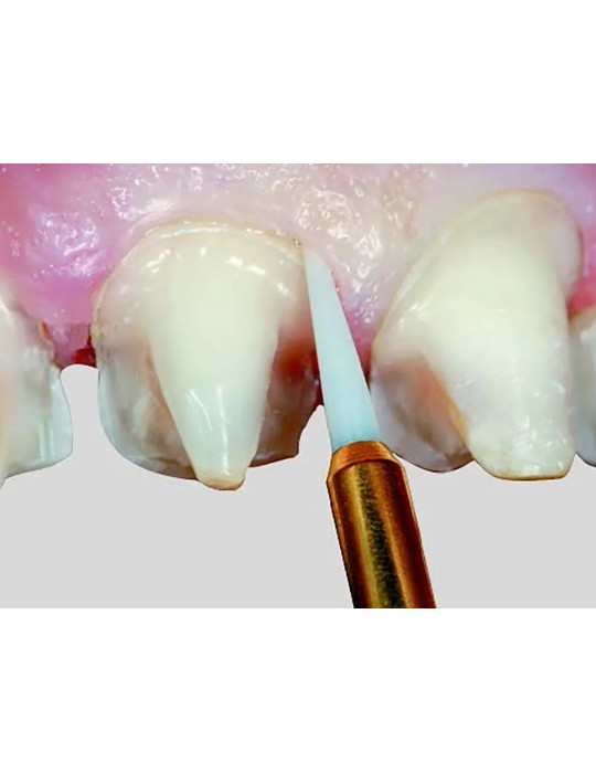 Fraises d'éviction gingivale
