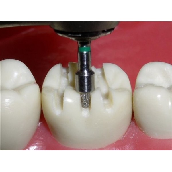 Fraises diamantées de réduction occlusale