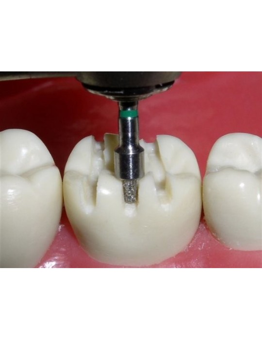 Fraises diamantées de réduction occlusale