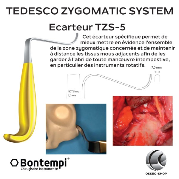 Tedesco Zygomatic System - Bontempi