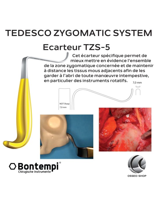 Tedesco Zygomatic System - Bontempi