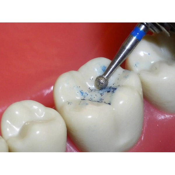 Fraise boule diamantée retouche céramique Magic Touch