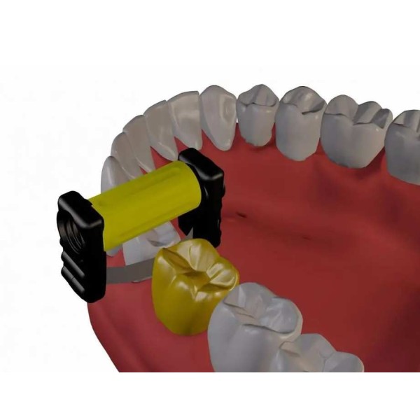 Pack de bandes strips d'orthodontie