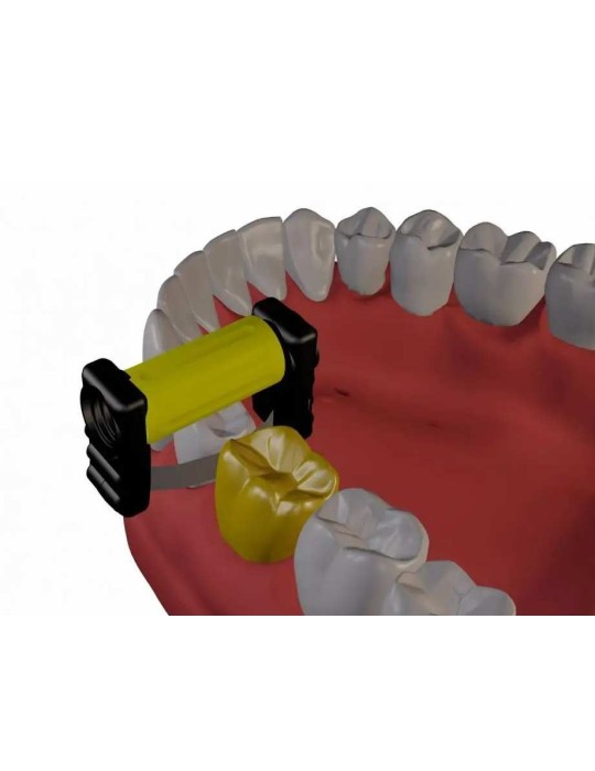 Pack de bandes strips d'orthodontie