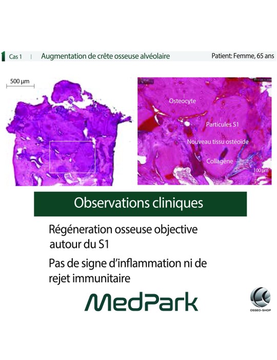 S1 - Substitut osseux "STICKY BONE" origine bovine