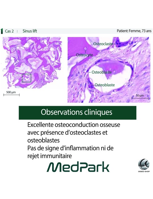 S1 - Substitut osseux "STICKY BONE" origine bovine