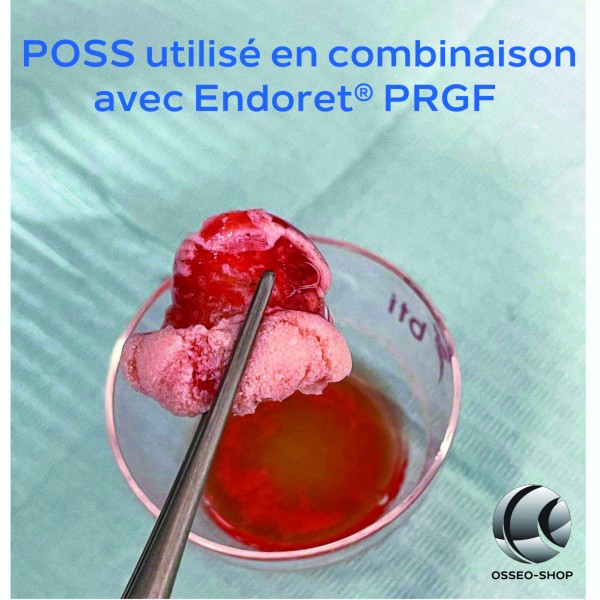 POSS - Substitut osseux d’origine porcine