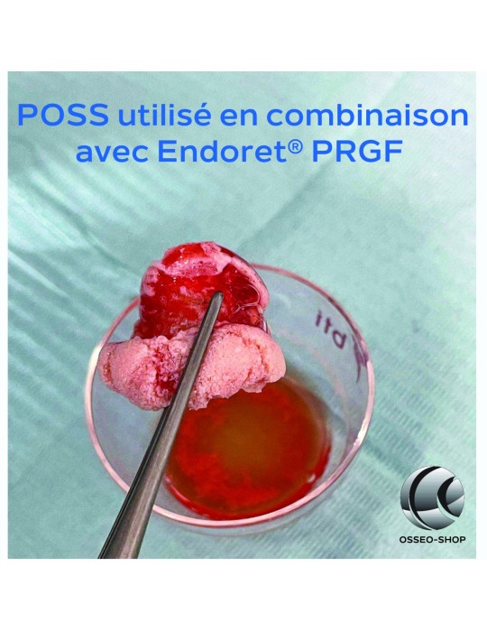 POSS - Substitut osseux d’origine porcine
