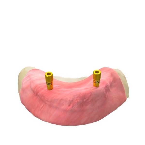 Broche de fixation guidée – verticale, QN/H8/d3,5 (GS)