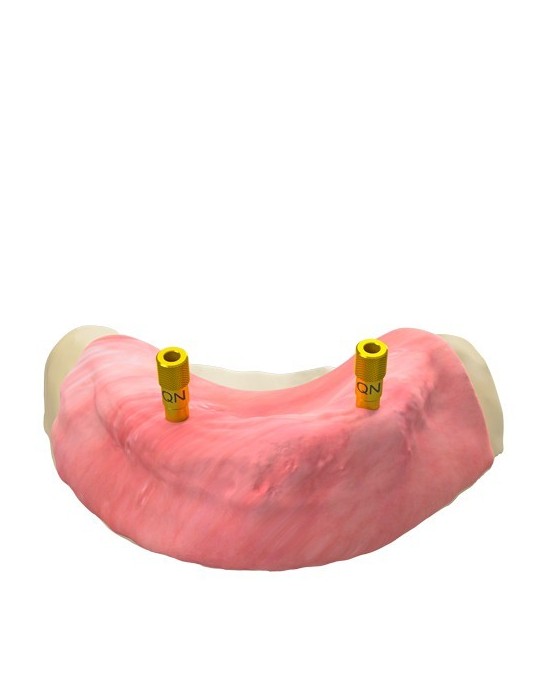 Broche de fixation guidée – verticale, QN/H8/d3,5 (GS)