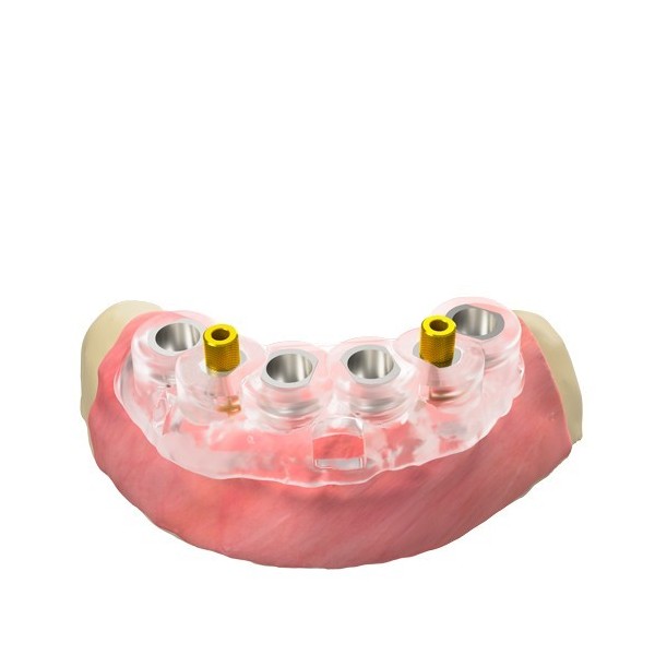 Broche de fixation guidée – verticale, QN/H8/d3,5 (GS)