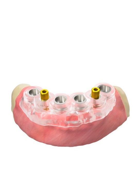 Broche de fixation guidée – verticale, QN/H8/d3,5 (GS)