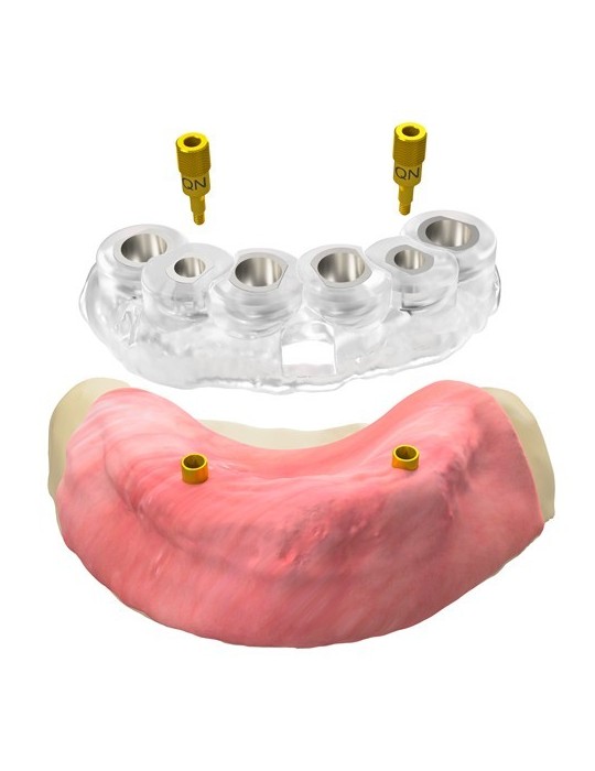 Broche de référence pour chirurgie guidée, QN/L7/d2.9/C4.6 (GS)