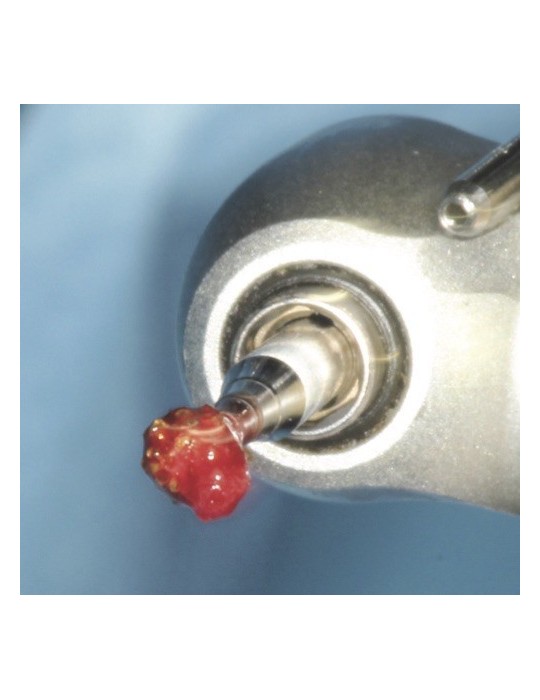 Kit de dégranulation - 5 fraises