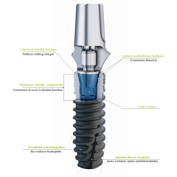 Implant BioniQ S5.0