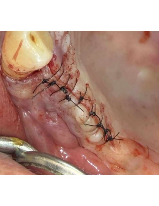 32.90€ les 12 Sutures Nylon - Non Résorbable Monofilament