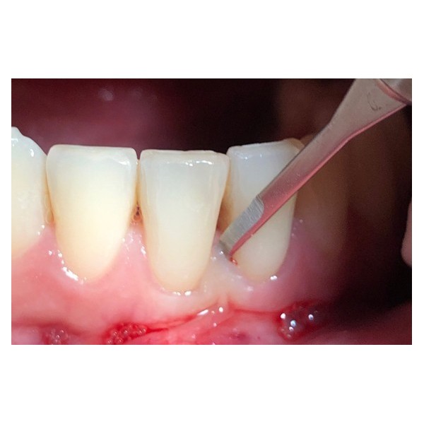 Boîte de 10 micro-lames MJK