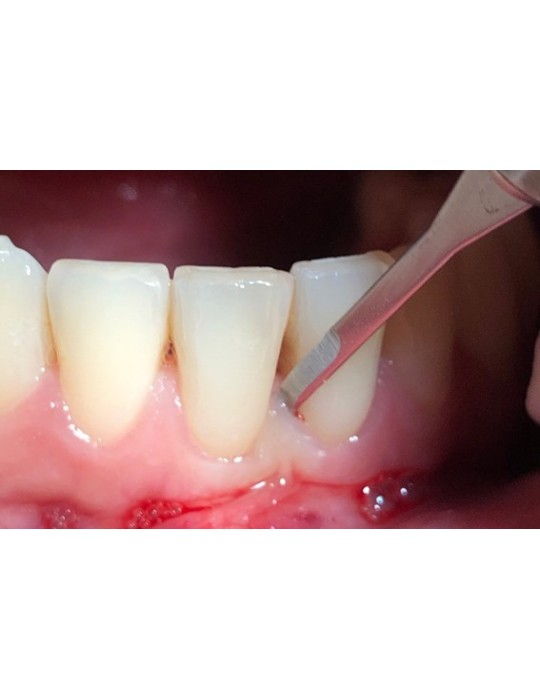Boîte de 10 micro-lames MJK