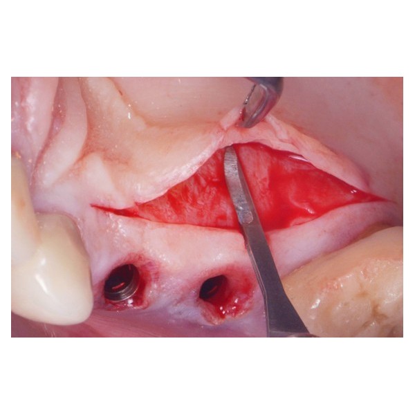 Boîte de 10 micro-lames MJK