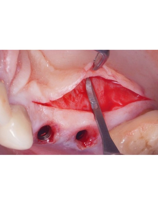 Boîte de 10 micro-lames MJK