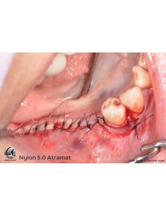 32.90€ les 12 Sutures Nylon - Non Résorbable Monofilament