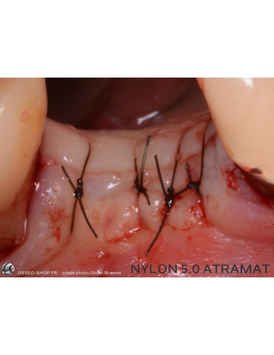 32.90€ les 12 Sutures Nylon - Non Résorbable Monofilament