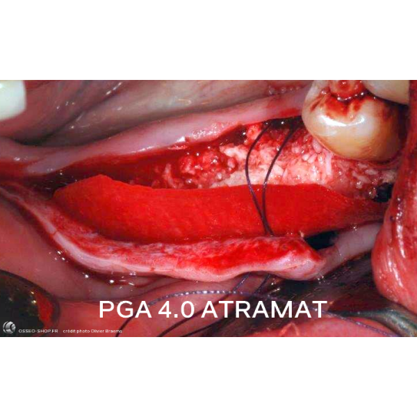 50.90€ - Boîte de 12 Sutures PGA - Résorbable Tressé
