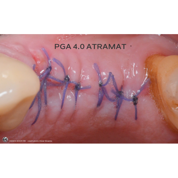 50.90€ - Boîte de 12 Sutures PGA - Résorbable Tressé
