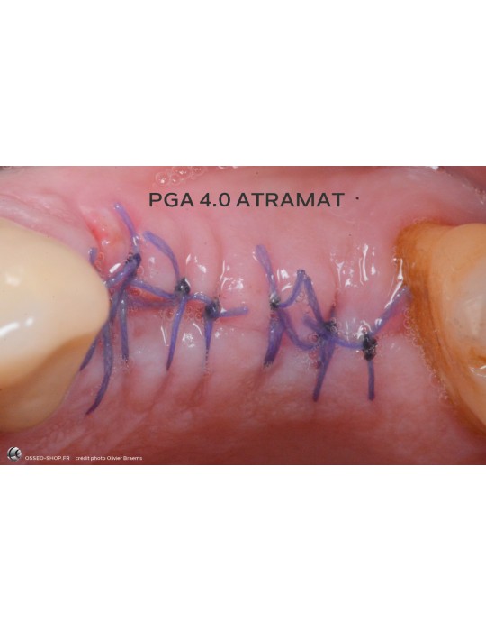 50.90€ - Boîte de 12 Sutures PGA - Résorbable Tressé