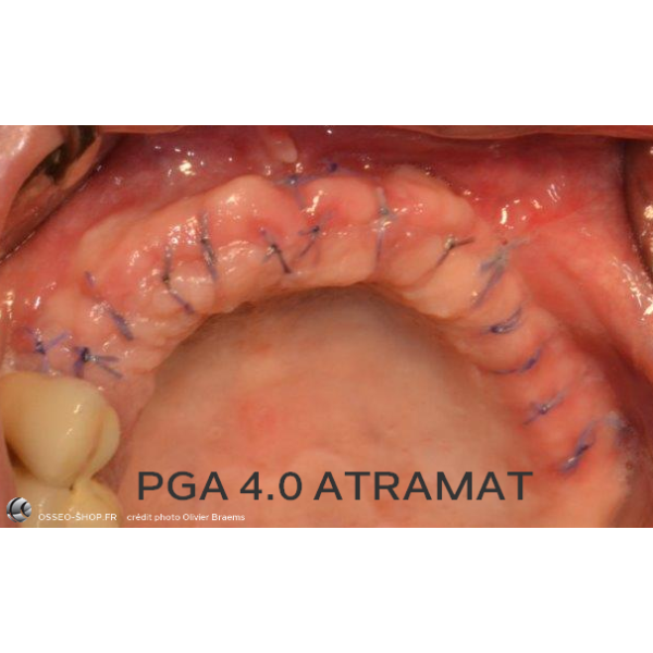 50.90€ - Boîte de 12 Sutures PGA - Résorbable Tressé