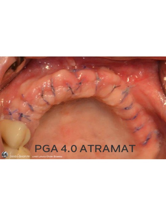 50.90€ - Boîte de 12 Sutures PGA - Résorbable Tressé