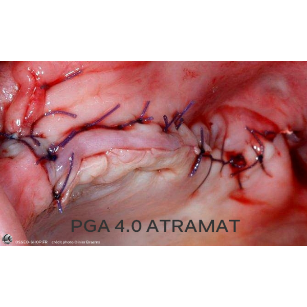 50.90€ - Boîte de 12 Sutures PGA - Résorbable Tressé