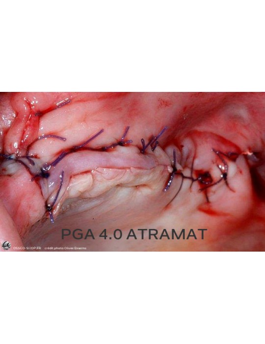 50.90€ - Boîte de 12 Sutures PGA - Résorbable Tressé