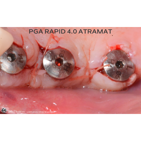 52.90€ - Boîte de 12 Sutures PGA RAPID - Résorbable Rapide Tressé