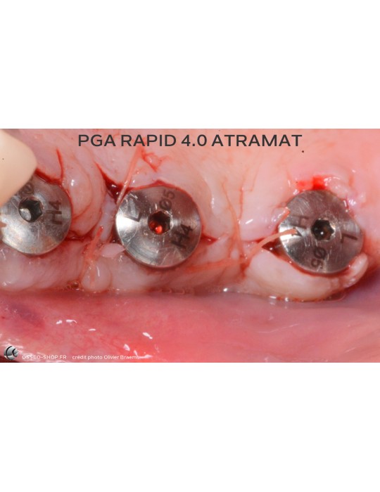 52.90€ - Boîte de 12 Sutures PGA RAPID - Résorbable Rapide Tressé