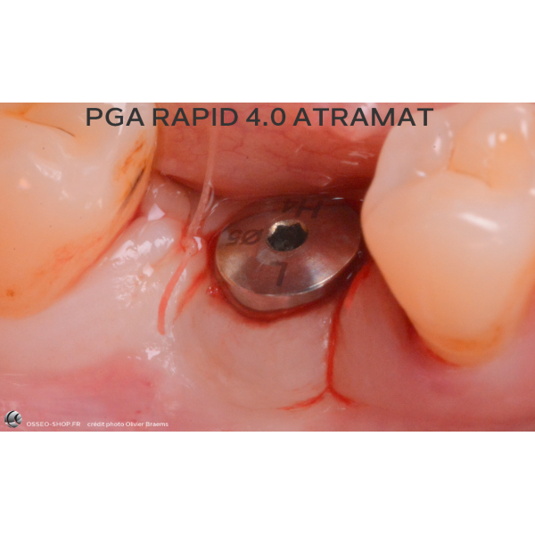 52.90€ - Boîte de 12 Sutures PGA RAPID - Résorbable Rapide Tressé