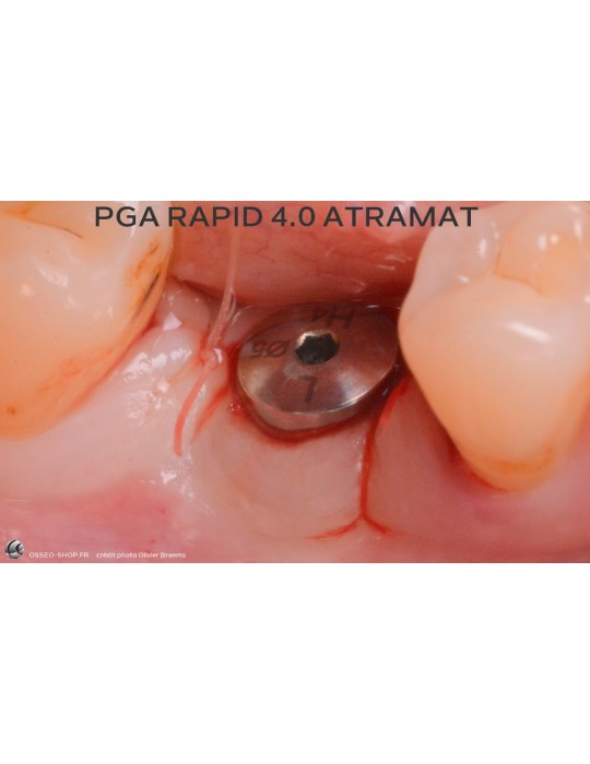 52.90€ - Boîte de 12 Sutures PGA RAPID - Résorbable Rapide Tressé