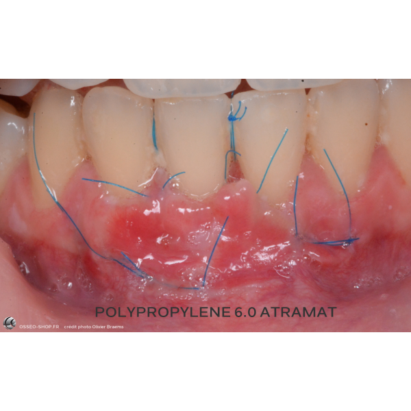 Sutures dentaire Non résorbable monofilament Polypropylène Atramat Boîte de 12 fils 42.