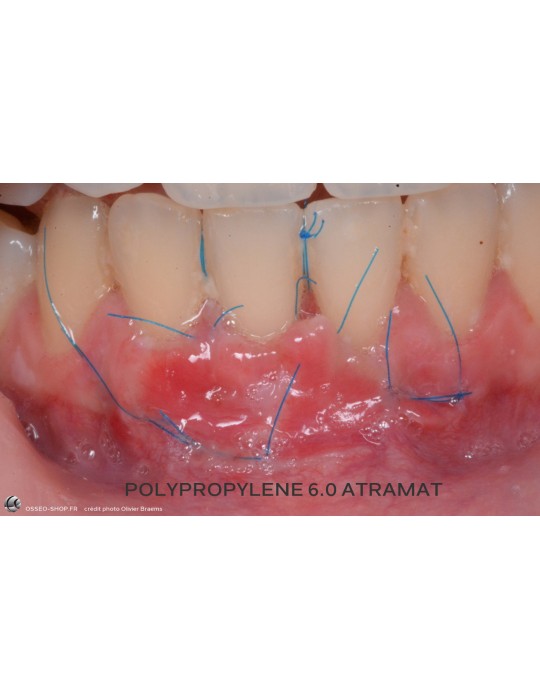 42.90€ les 12 Sutures Polypropylene - Non Résorbable Monofilament