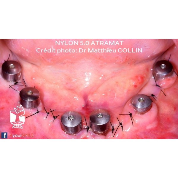 32.90€ les 12 Sutures Nylon - Non Résorbable Monofilament