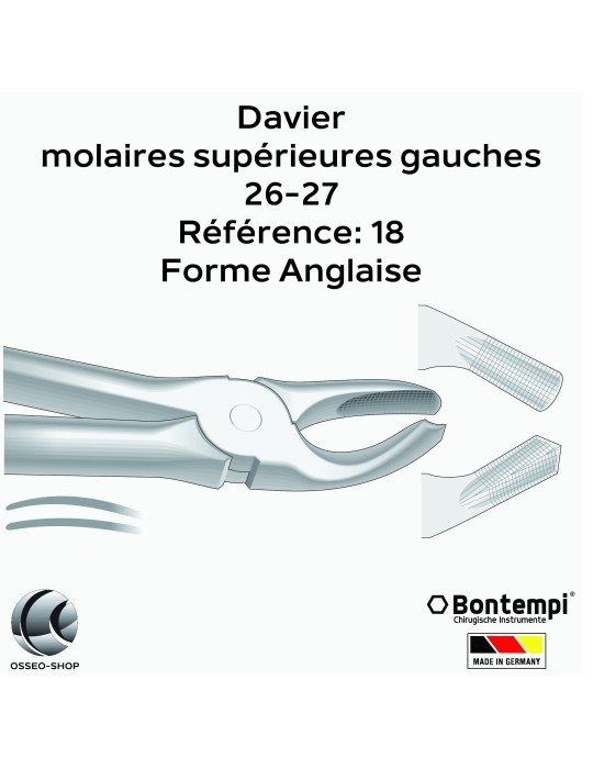 Daviers - Molaires supérieures gauches - Bontempi