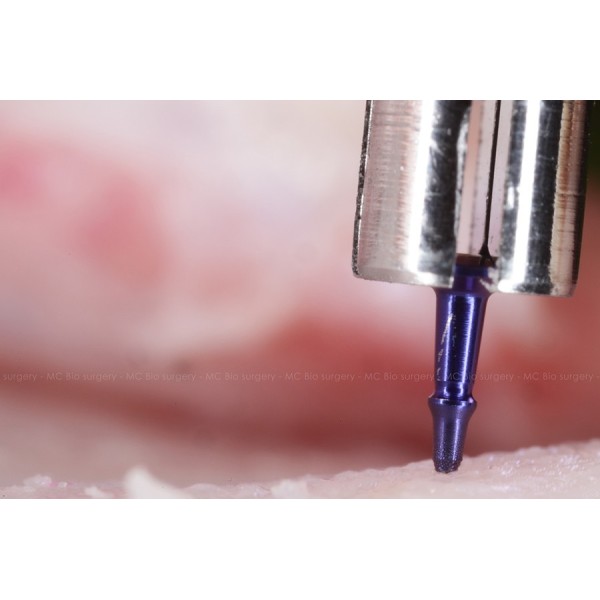 Pins Titane - MC Bio Surgery
