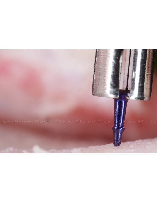 Pins Titane - MC Bio Surgery