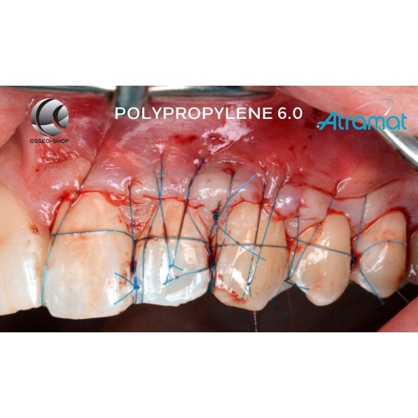 Sutures dentaire Non résorbable monofilament Polypropylène Atramat Boîte de 12 fils 42.