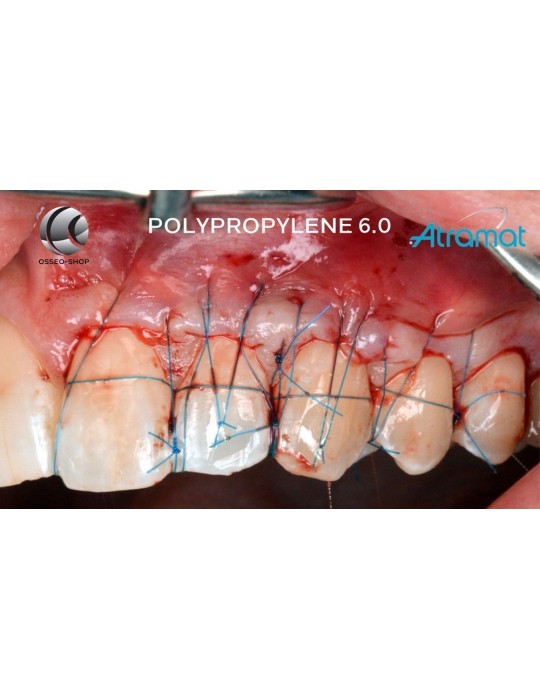 42.90€ les 12 Sutures Polypropylene - Non Résorbable Monofilament