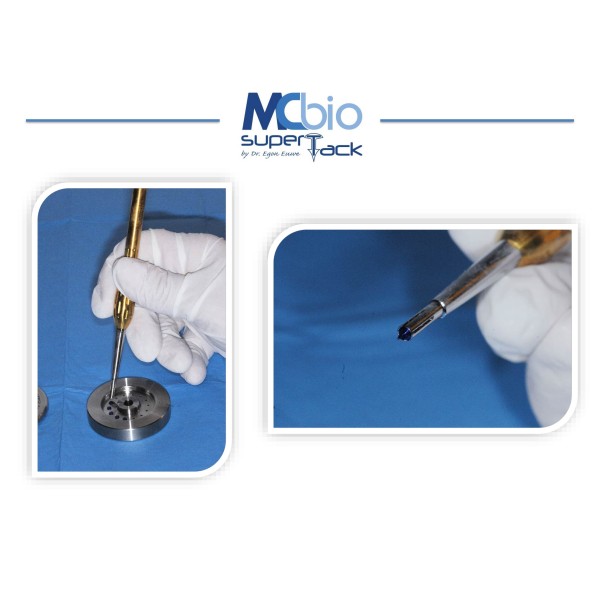Applicateur Pins Super Tack et accessoires- MC bio Surgery