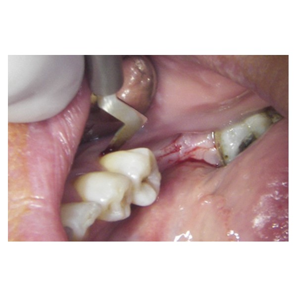 Boîte de 10 lames de bistouri stériles MJK -  35.75€ TTC