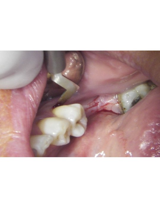 Boîte de 10 lames de bistouri stériles MJK -  35.75€ TTC